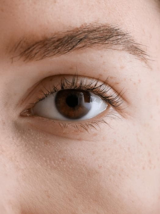 Upper blepharoplasty