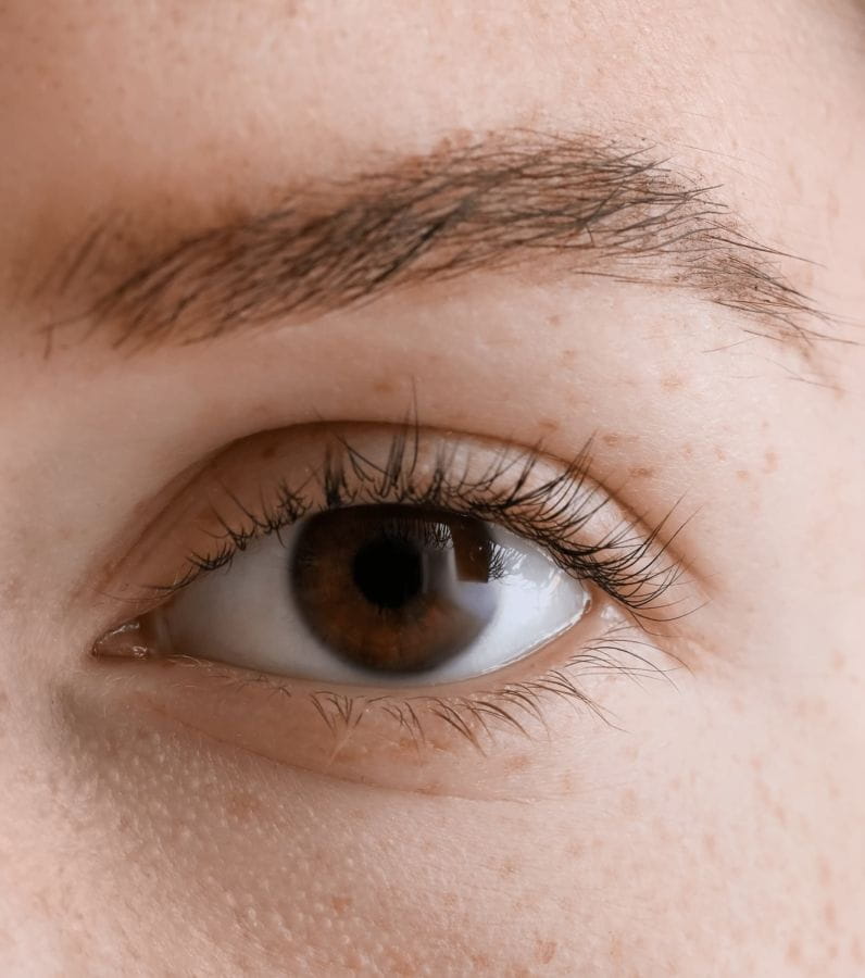 blépharoplastie supérieure