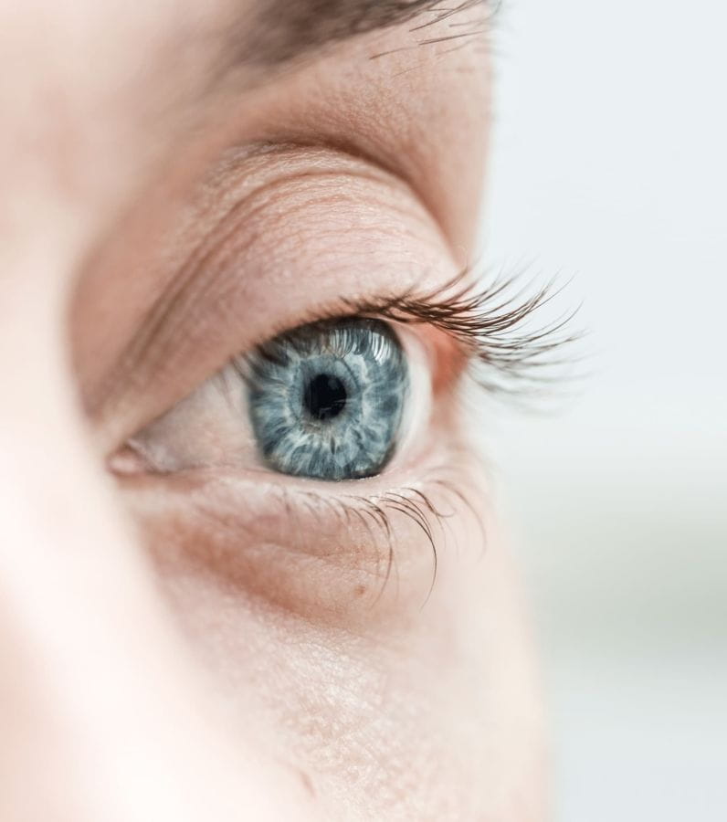 Blépharoplastie supérieure pour la femme