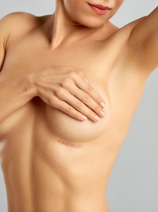 Removal of breast implants