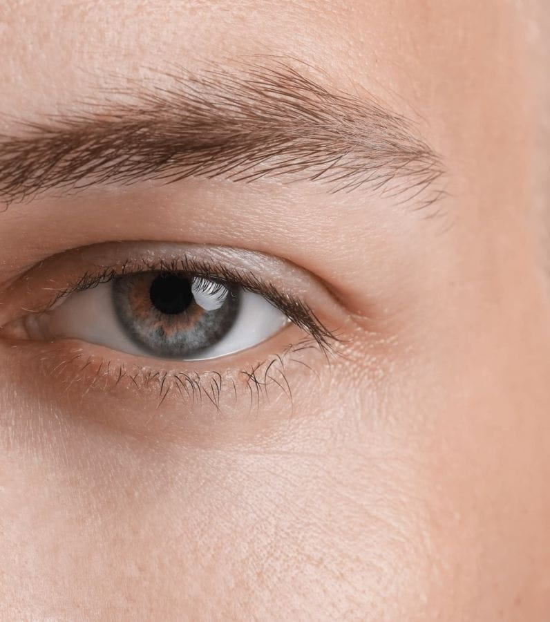 blépharoplastie inférieure homme