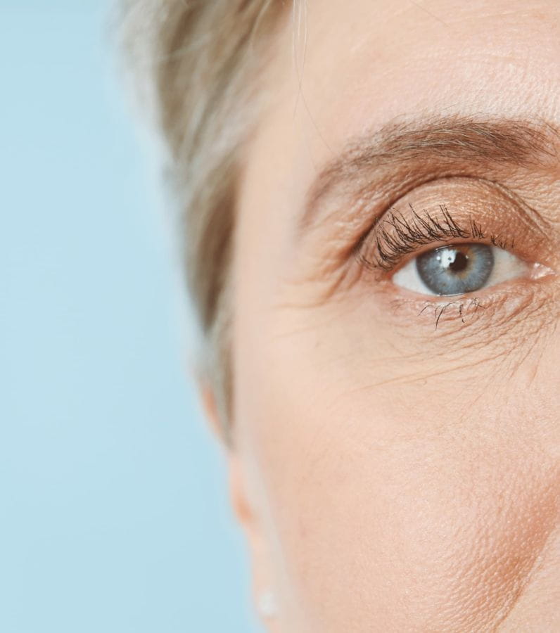 blépharoplastie des 4 paupières