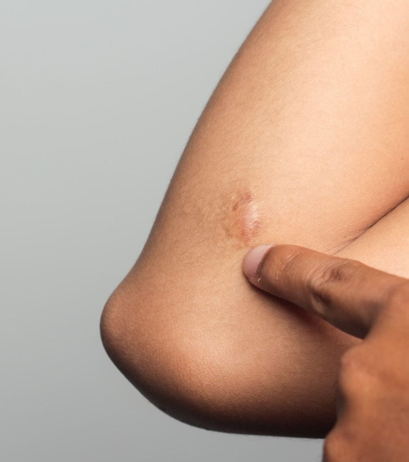 chirurgie pédiatrique lésions