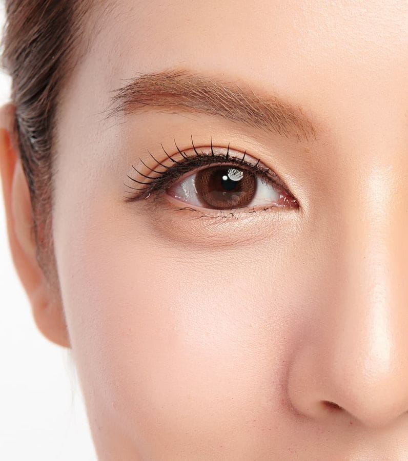 blépharoplastie asiatique femme